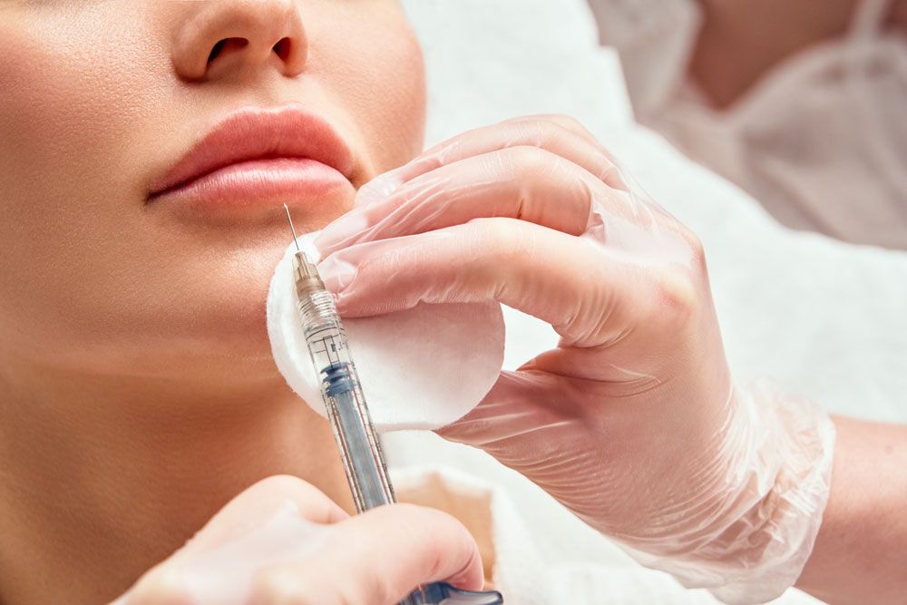 lip filler injection